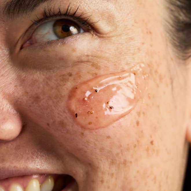 Close-up of a person's face with a blemish on their cheek