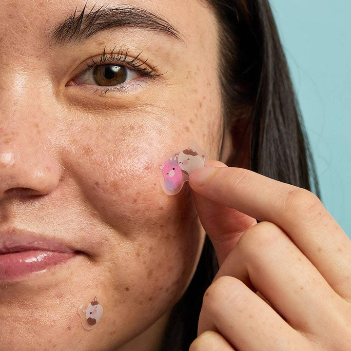 girl modeling the blemish patchon her face. 